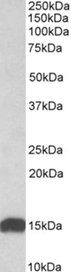 Goat anti-NDUFS6 Antibody