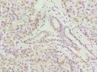 CMC1 antibody