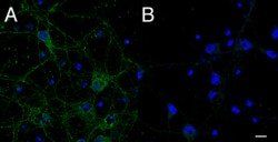 Goat anti-CMG1 / CCDC2 / IFT74 Antibody