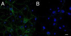 IFT74 antibody