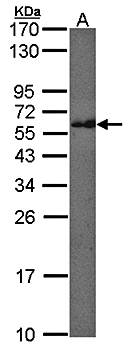 CMG1 Rabbit Polyclonal Antibody