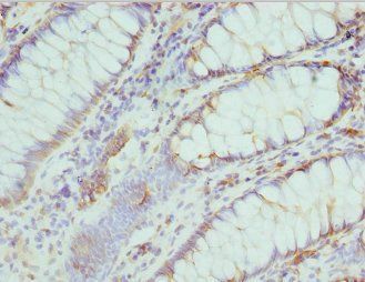 CMPK1 Antibody