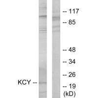 CMPK1 Antibody