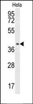 CMPK2 antibody