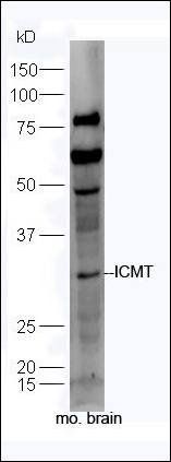 CMT antibody