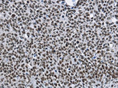 CMTM2 Antibody