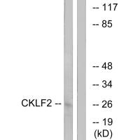 CMTM2 Antibody