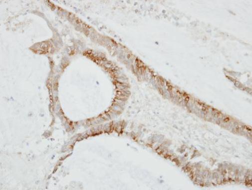 CMTM6 antibody [C1C3]