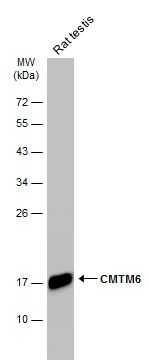 CMTM6 antibody [C1C3]