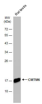 CMTM6 antibody