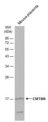 CMTM6 antibody [C1C3]