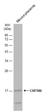 CMTM6 antibody