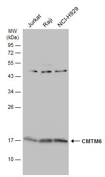 CMTM6 antibody