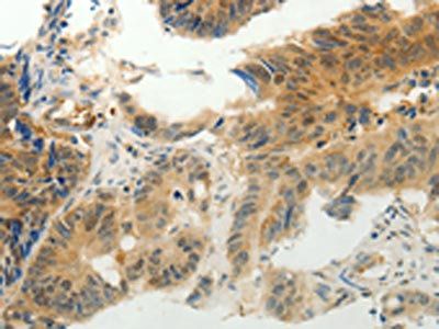CMTM7 Antibody