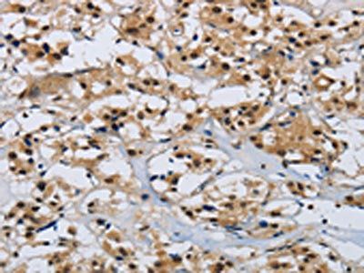 CMTM8 Antibody