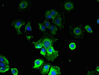 CMTR2 Antibody