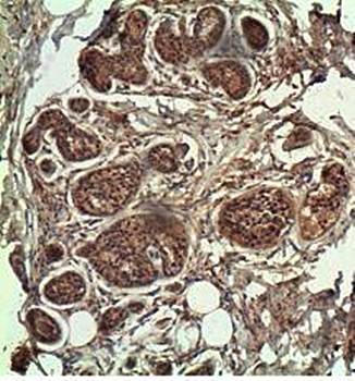 C-Myc Rabbit Polyclonal Antibody