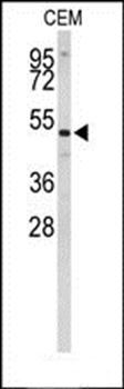 CNDP1 antibody