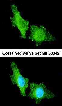 CNGA2 antibody