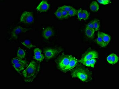 CNIH3 antibody