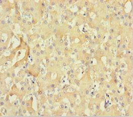 CNKSR2 Antibody