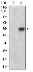 CNN1 Antibody