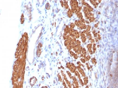 Calponin-1 (Smooth Muscle Marker) Antibody