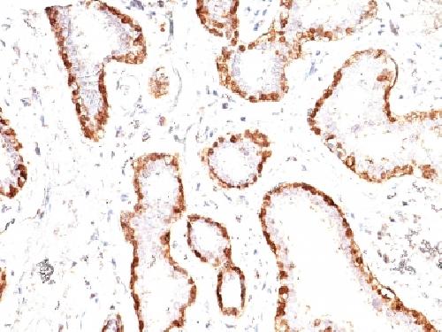 Calponin-1 (Smooth Muscle Marker) Antibody