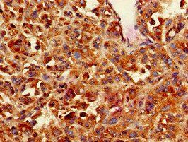 CNN3 Antibody