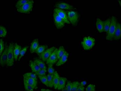 CNNM2 antibody