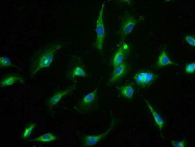 CNNM3 antibody