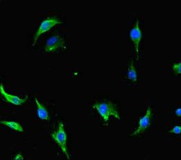 CNOT1 Antibody