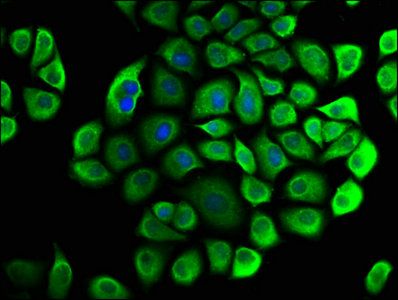 CNOT3 antibody