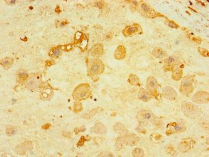 CNPY4 antibody