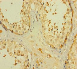 CNTNAP1 Antibody