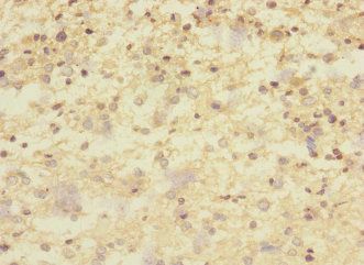 CNTNAP1 Antibody