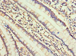 COL2A1 Antibody