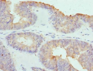 COCH Antibody