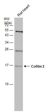 cofilin 2 Antibody