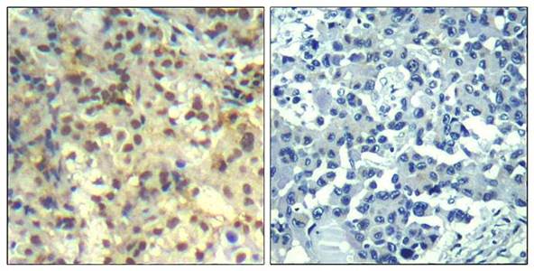 cofilin1 (phospho-Tyr139) Antibody