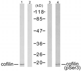cofilin (Phospho-Ser3) Antibody
