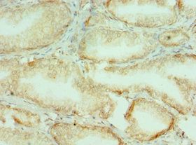 COL10A1 Antibody