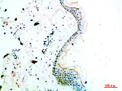 COL14A1 Antibody
