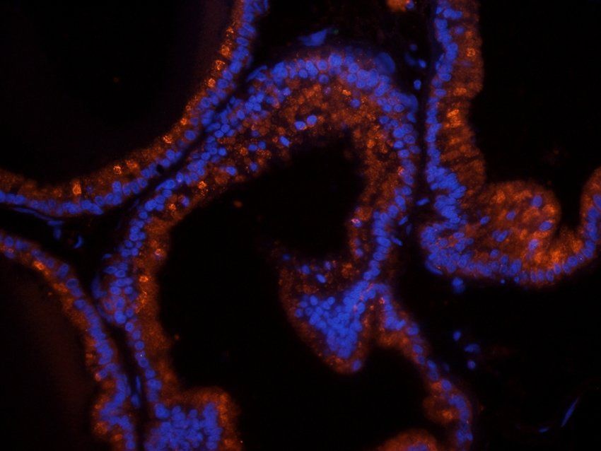 COL17A1 antibody