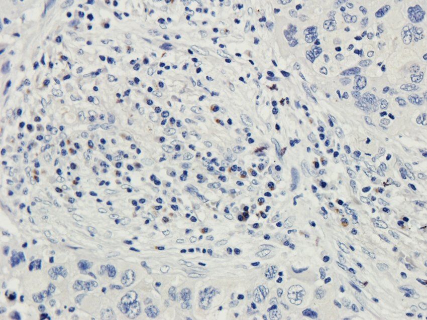 COL17A1 antibody