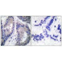 COL18A1 Antibody