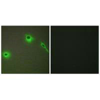 COL18A1 Antibody