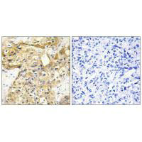 COL18A1 Antibody