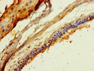 COL20A1 Antibody