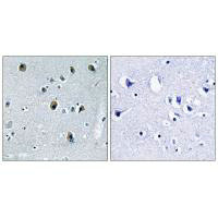 COL20A1 Antibody